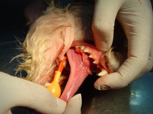 Así queda una boca después de una limpieza dental exsahustiva.